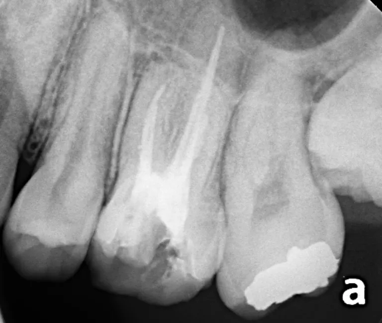 (22歳男性。2024/11/28撮影)
