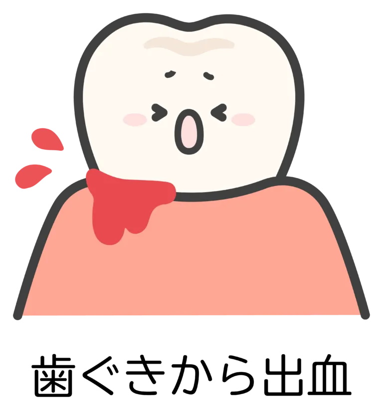 歯ぐきから出血するイラスト