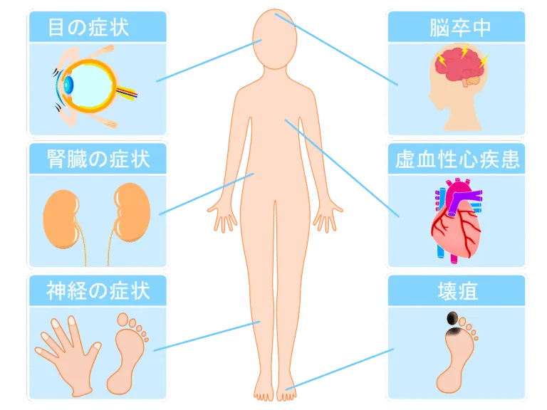 怖い糖尿病の合併症