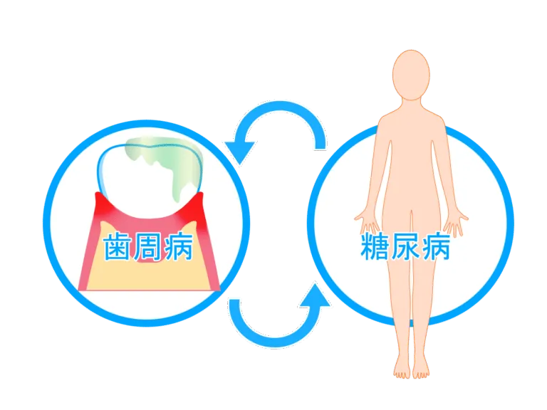 歯周病との関連