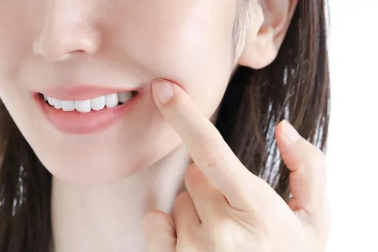 オフィスホワイトニング、始めました