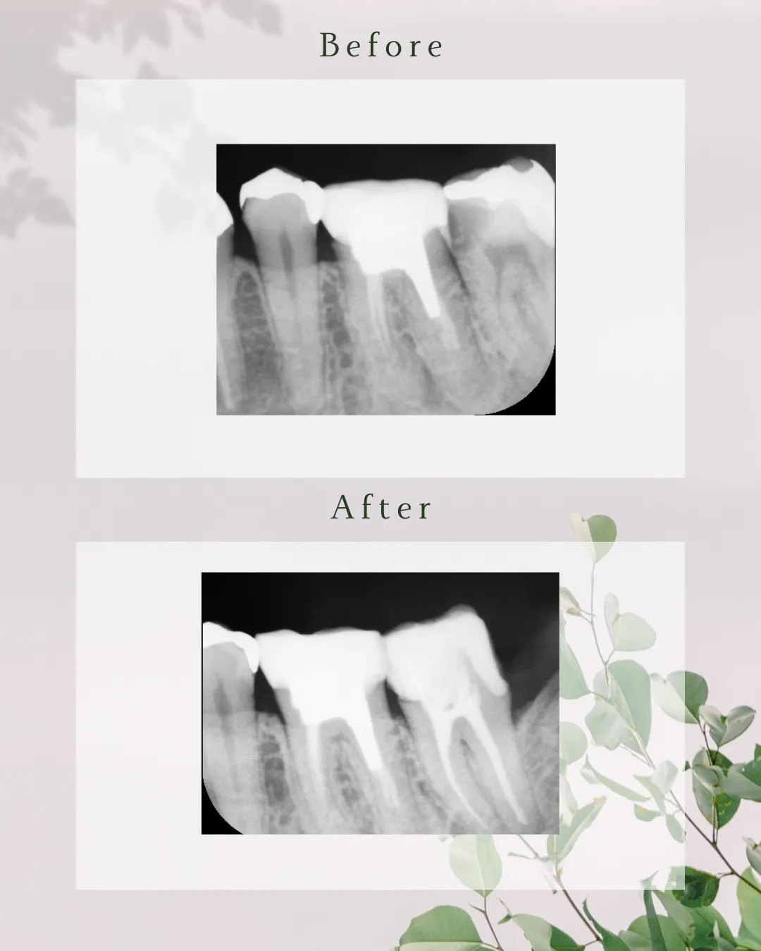 こんにちは!神戸元町 玉川歯科医院です🙂