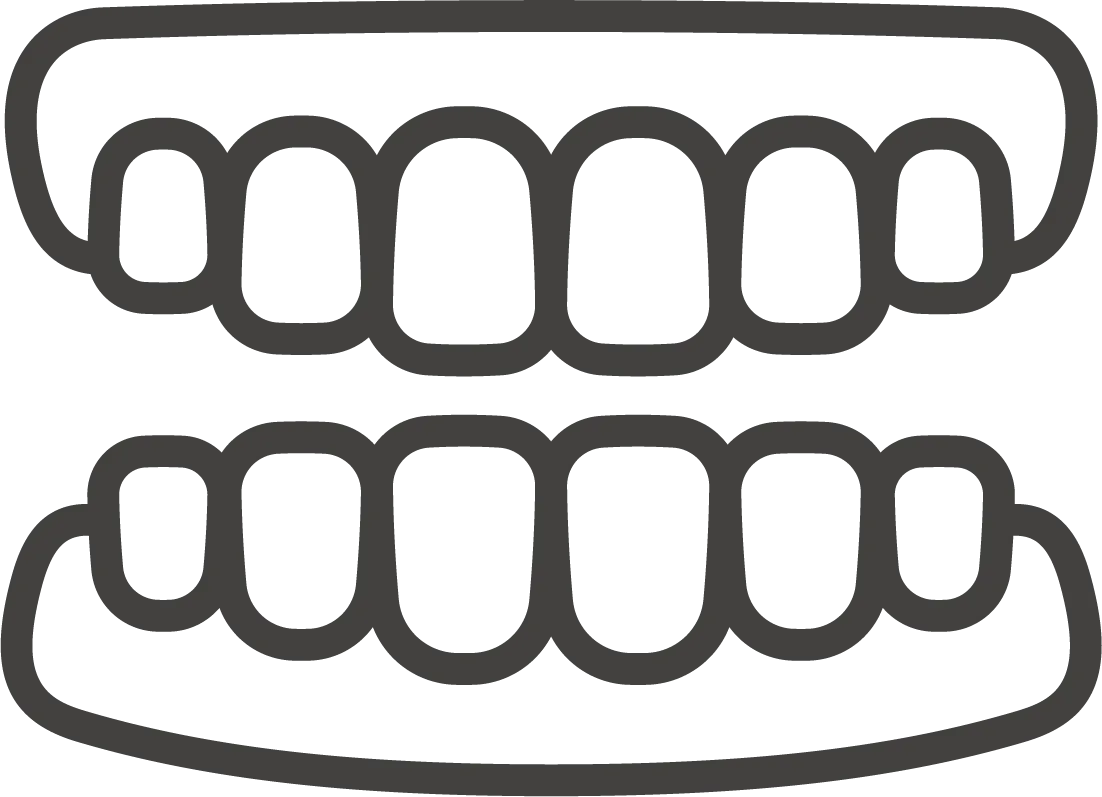 インビザライン