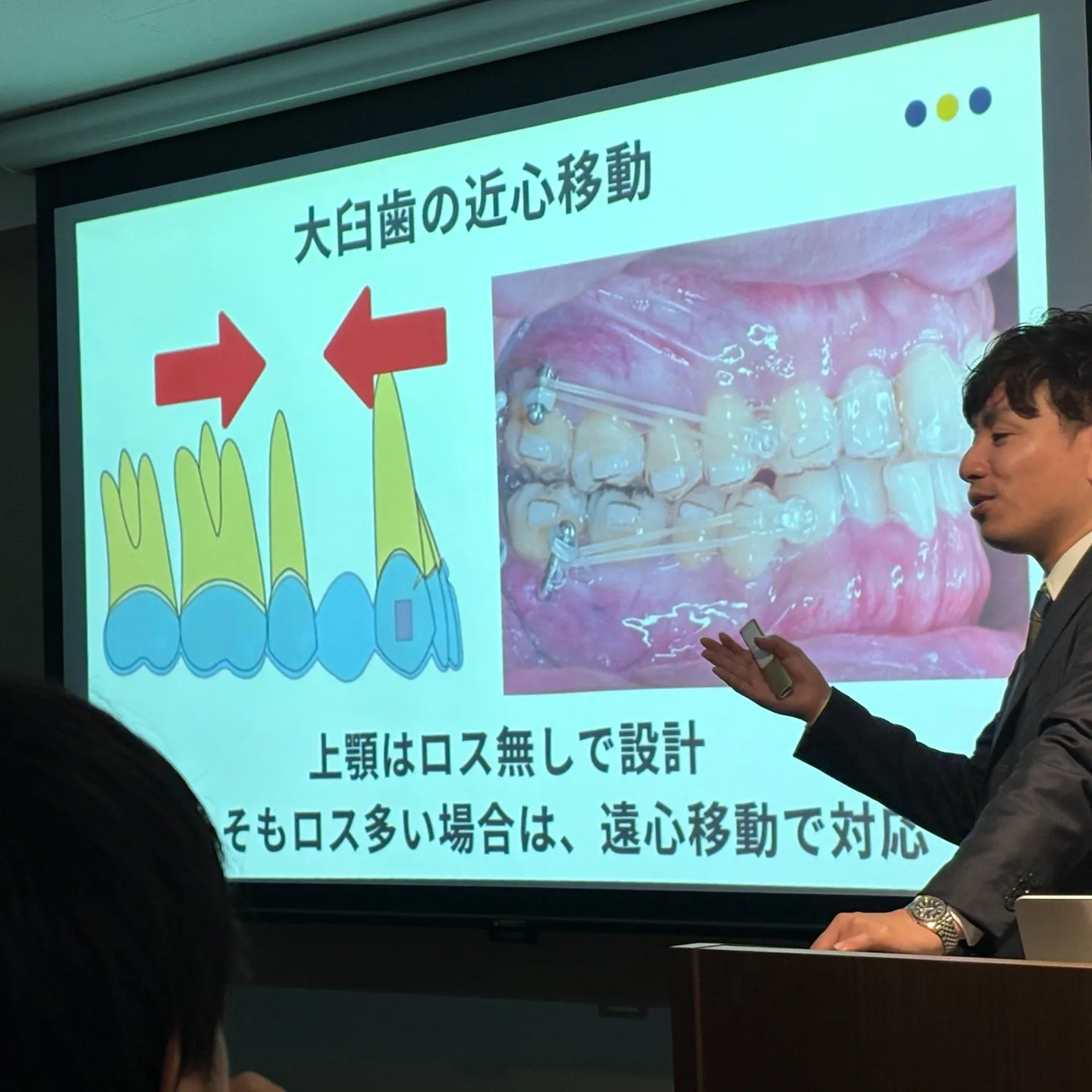 矯正の勉強会に参加してきました。
