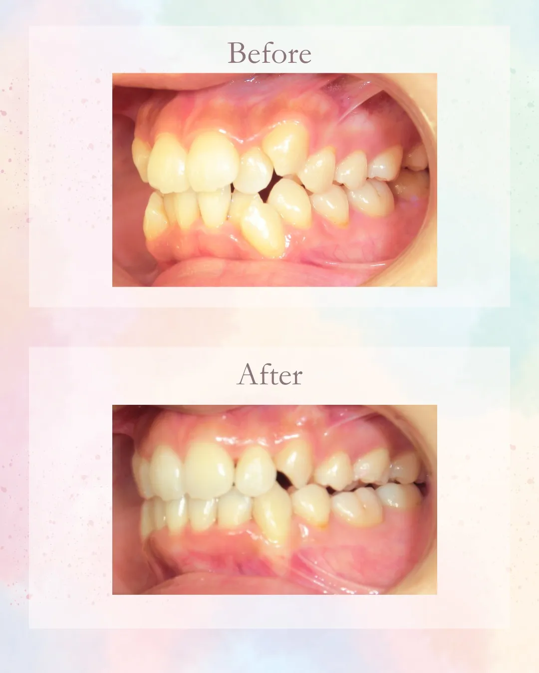 こんにちは!神戸元町 玉川歯科医院です🙂