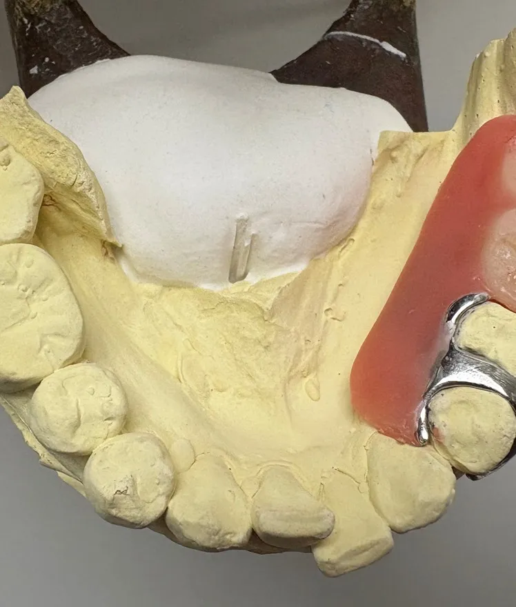 入れ歯とはどんなものかご紹介!こんにちは!神戸元町 玉川歯科...