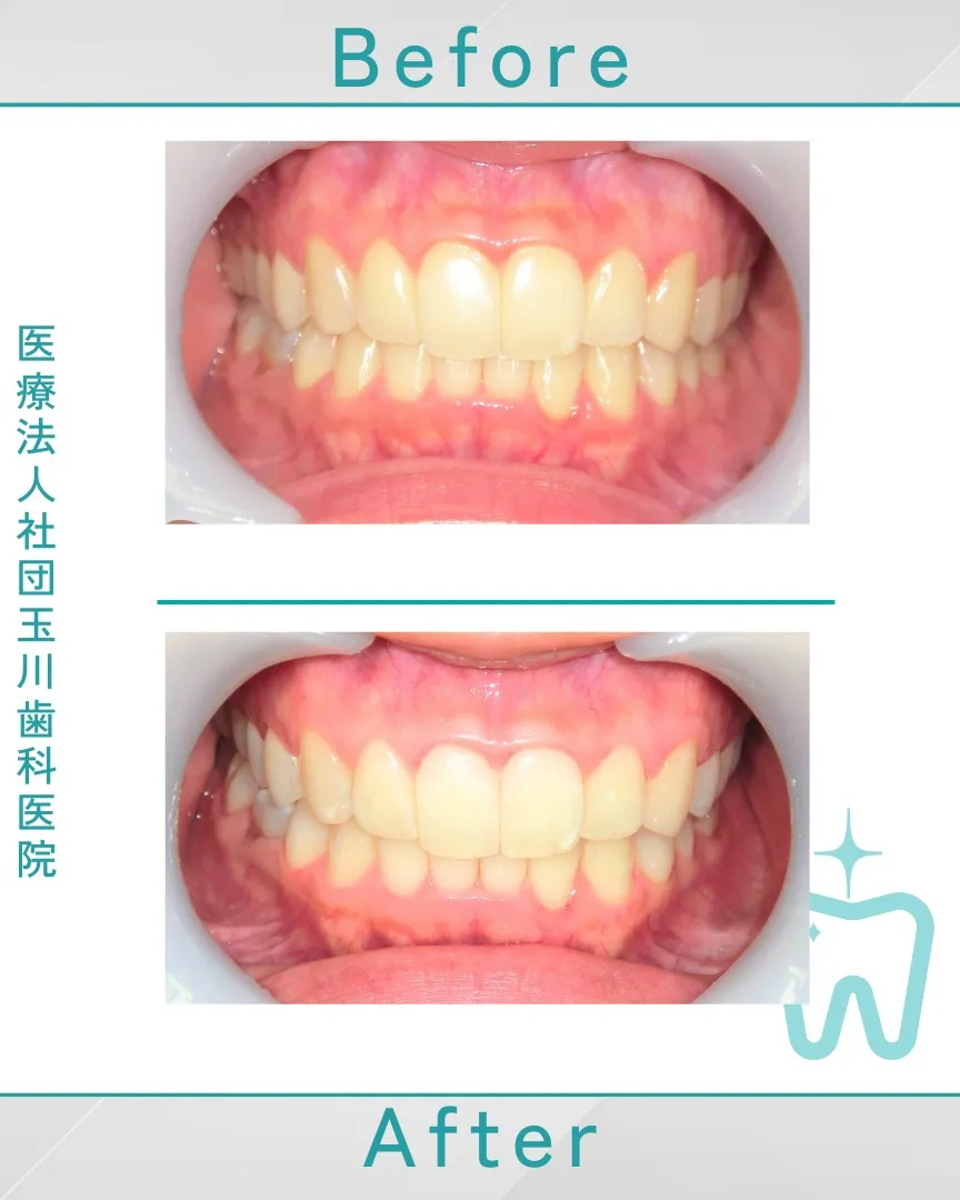 素敵な笑顔は白い歯から。