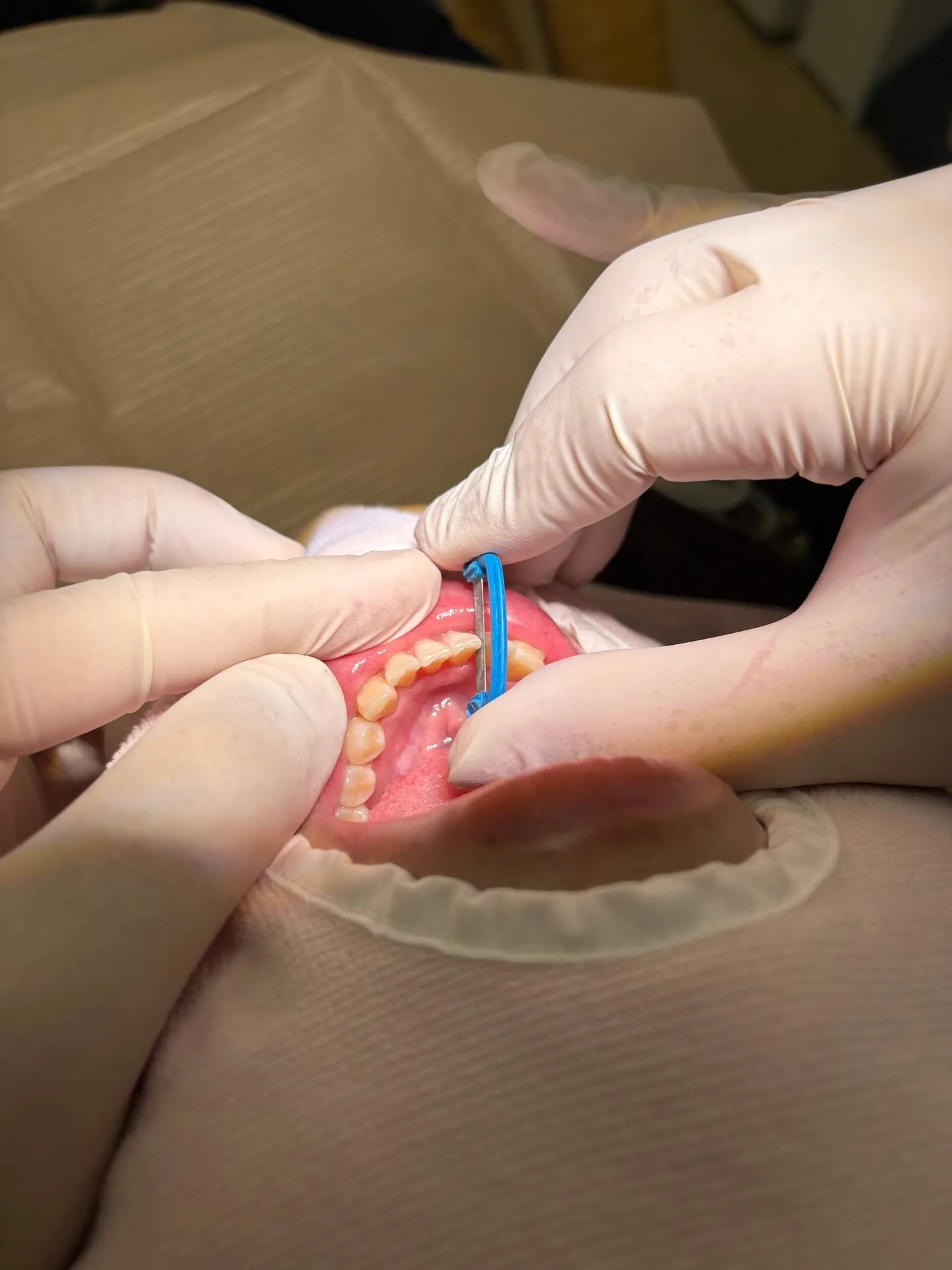 歯を抜かずに矯正！こんにちは！神戸元町　玉川歯科医院です🙂