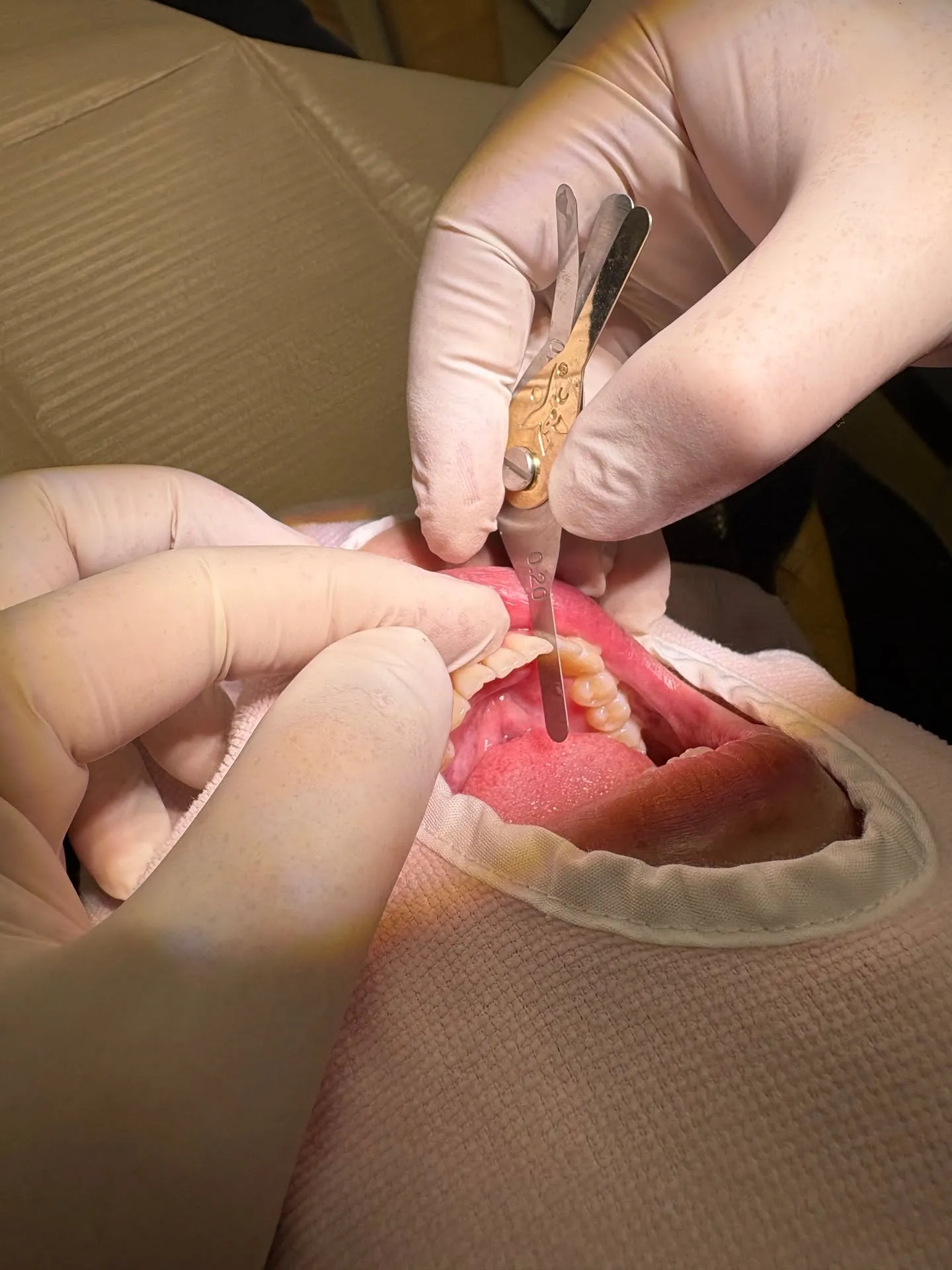 歯を抜かずに矯正!こんにちは!神戸元町 玉川歯科医院です🙂