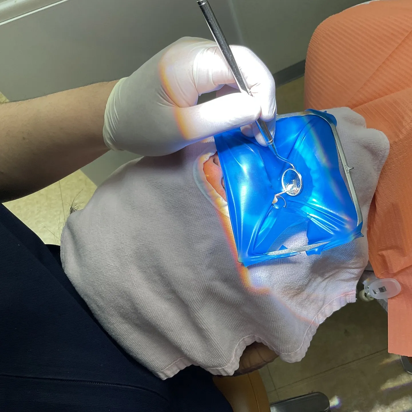 ラバーダムでの根管治療は基本!神戸元町 玉川歯科医院です🙂