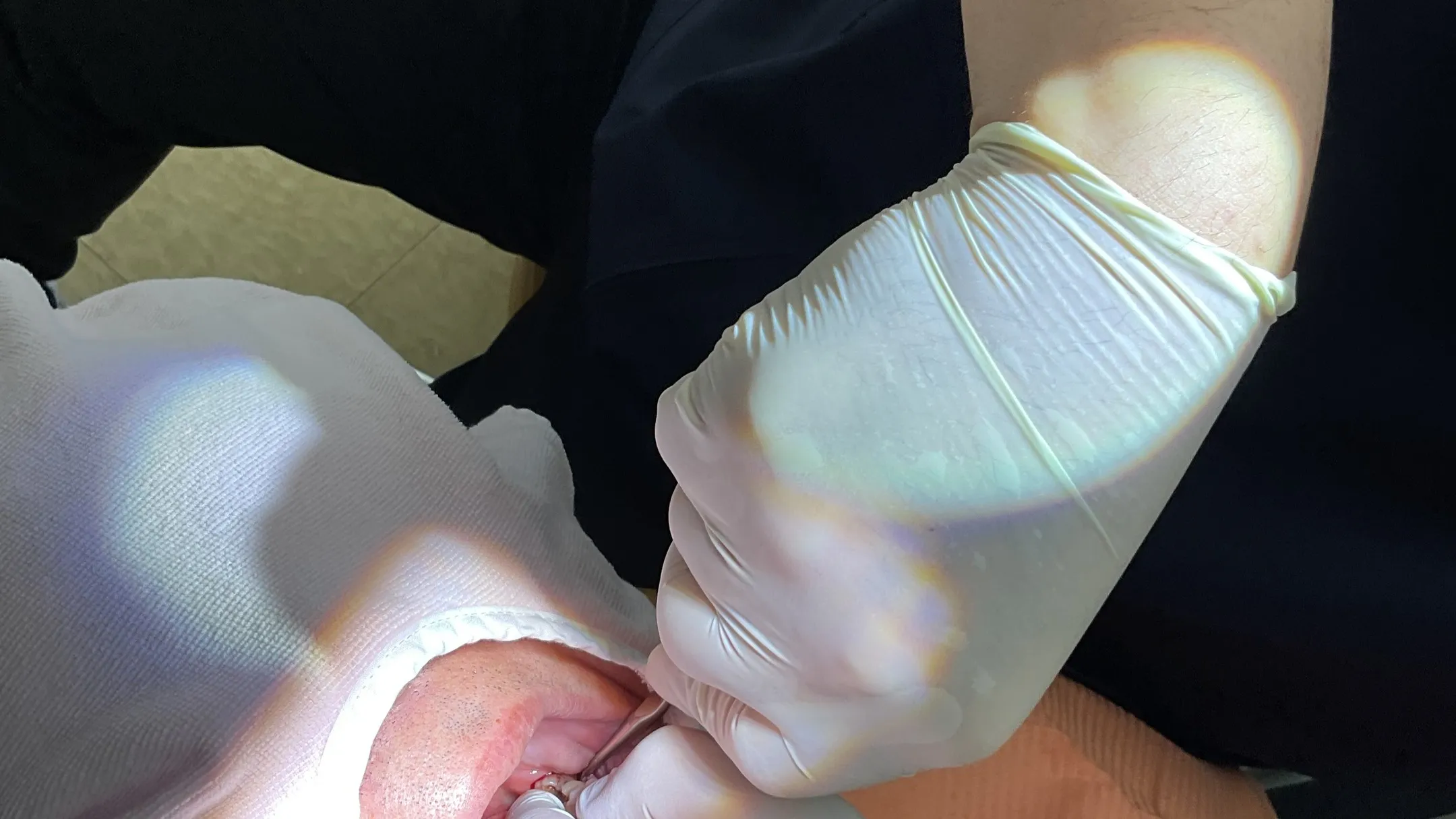 抜歯についてご紹介！神戸元町　玉川歯科医院です🙂