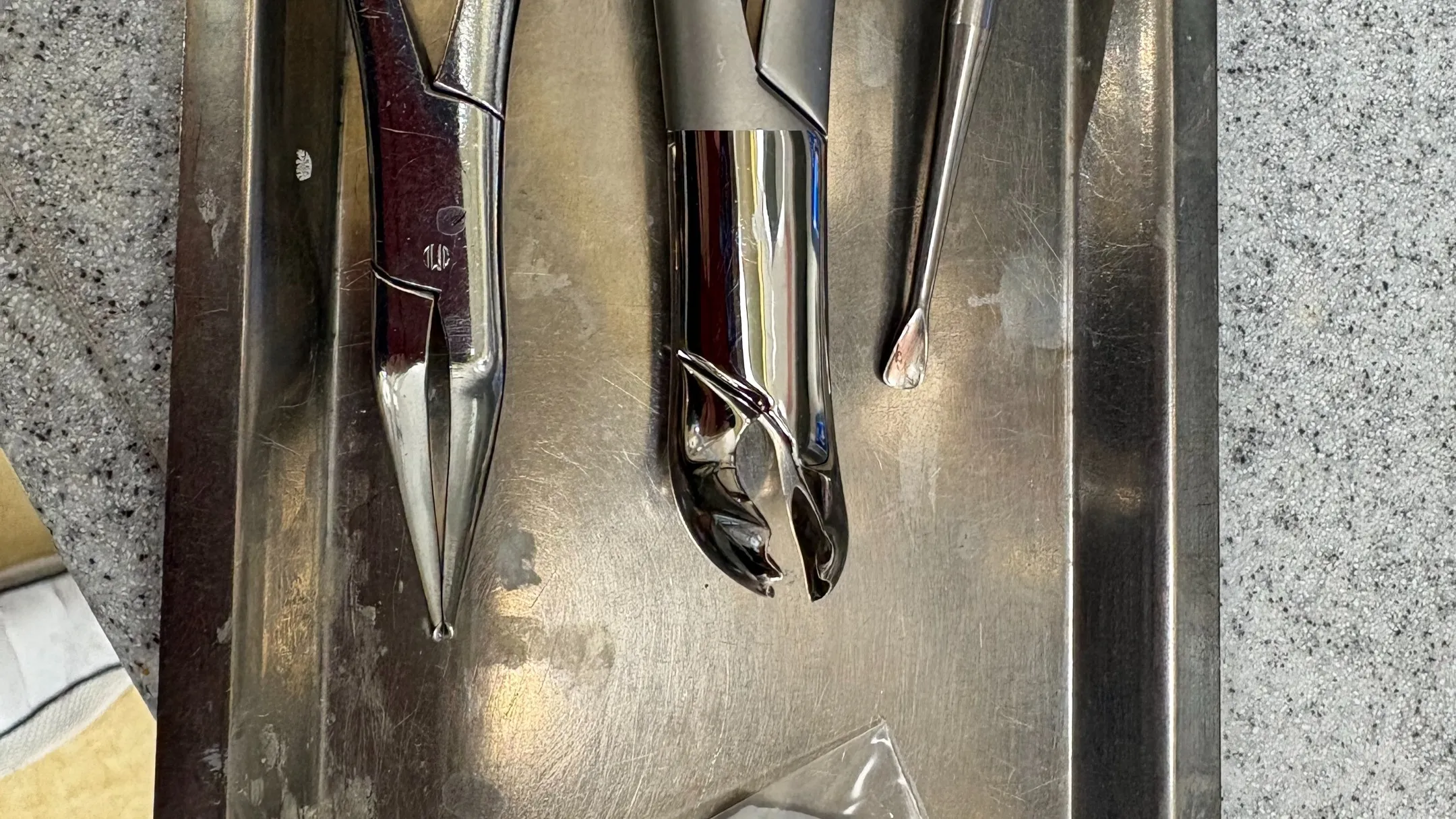 抜歯についてご紹介！神戸元町　玉川歯科医院です🙂