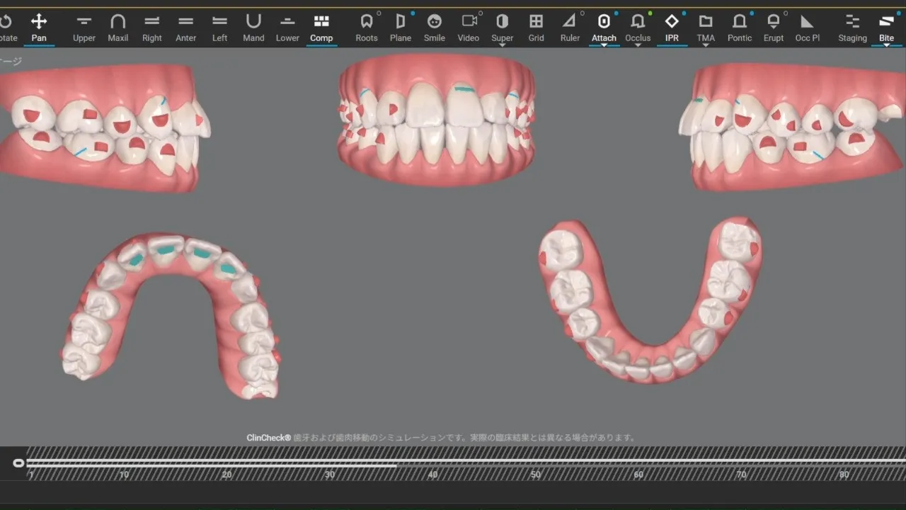 新型iTero導入！こんにちは！神戸元町　玉川歯科医院です🙂